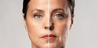 علت افتادگی پوست چیست و چگونه می توان آن را درمان کرد؟